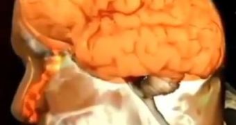 Man's nose leaks brain fluid for 18 months