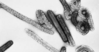 Miscroscope image of Marburg virus particles