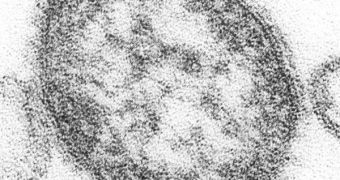 This is how the Rubeola virus looks like