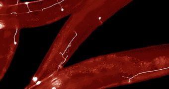 MIT engineers have developed a way to rapidly perform surgery on single nerve cells in the worm C. elegans