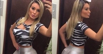Andressa Urach has been left with holes in her thighs, where fillers rotted the tissue