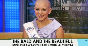 Redefining the concept of beauty: Kayla Martell could become the first bald Miss America