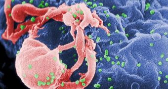 HIV can now be detected a lot easier in some of the world's poorest areas