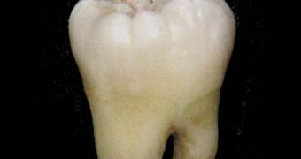 Molars can tell anthropologists a large number of facts about a certain species
