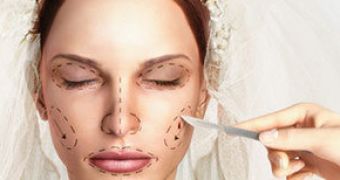 More brides are getting plastic surgery for their wedding day
