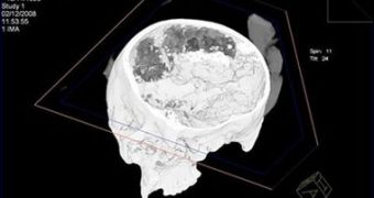 The darker part of the computer-generated image represents the brain remains