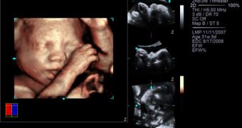 NVIDIA and Siemens Healthcare work together to enable 3D view of fetus
