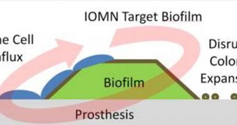 Iron-oxide nanoparticles developed at Brown University target an infected prosthesis, penetrate a bacterial film on the implant’s surface and thwart the colony by killing the bacteria. The nanoparticles also are believed to help natural bone cell growth