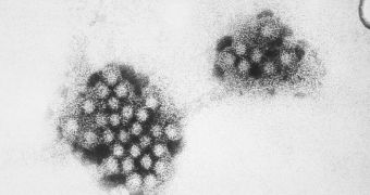 An electron micrograph of the Norovirus, with 27-32nm-sized viral particles