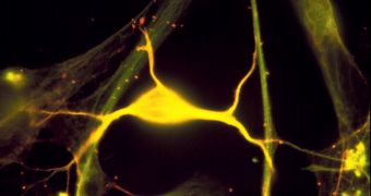 Electrodes now allow for the power of neurons to be harnessed