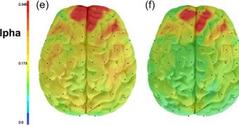 Maps showing the difference in the strength of brain connections between depressed subjects (left) and controls. Depressed subjects show much stronger connections, as evidenced by the red colors