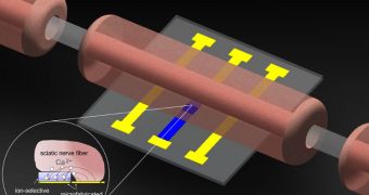 This is the Ion-Selective Microelectrodes for Low-Power Electrochemical Stimulation and Blocking of Neuromuscular Systems device developed at MIT