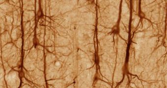 Neurons underlying the brain's ability to filter out useless information were recently discovered by Canadian researchers
