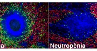 Neutrophils Found to Reside in the Spleen