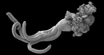 Bone-eating worm belonging to species named Osedax antarcticus