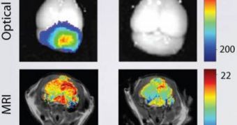This image shows a mouse brain tumor imaged using nanoparticles (left column) or conventional techniques (right column) combined with optical imaging and MRI. The nanoparticles give a clearer picture of the tumor, which is located at the back of the brain