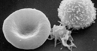 Scanning electron micrograph of T lymphocyte (right), a platelet (center) and a red blood cell (left)