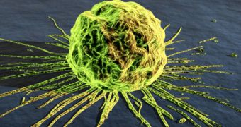 Artist's conception of a breast cancer cell