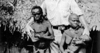 European among African pygmies