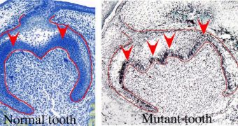 New Gene Involved in Tooth Formation Found