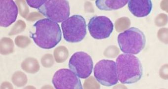 Inhibiting the PRC2 protein can stop acute myeloid leukemia in mice