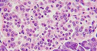 Pancreatic beta cells are housed in structures called islets of Langerhans