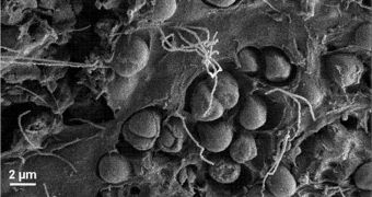 New microbe species found in plastic flotsam