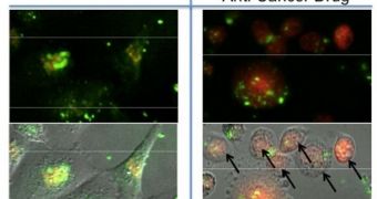 Nanoparticles (green) in breast cancer cells. In the control sample (left), the magnetic field is not turned on. In the test sample (right), an anticancer drug (red) is released into the cells, and the cells are killed