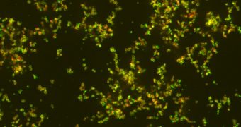 Nanoparticles, in green, targeting bacteria, shown in red