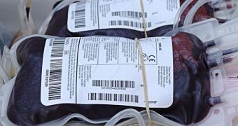 Bags of blood collected during donation, showing dark colour of venous blood