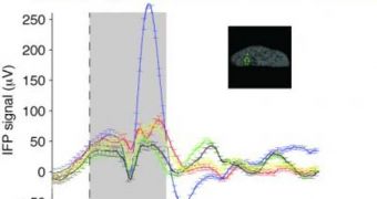 These are recordings from a single electrode, showing speed and strength of responses to different visual stimuli (red, animals; green, chairs; blue, human faces; black, fruit; yellow, vehicles). The inset brain image shows the location of the electrode