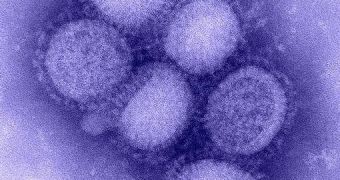 A SEM image of the H1N1 virus
