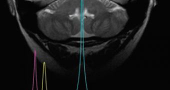 New neurons watched through NMR spectroscopy