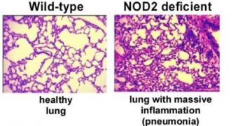 Image showing the effects of respiratory viruses on mice with and without the NOD2 gene