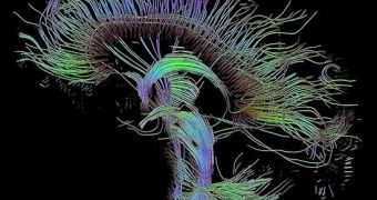 Visualization of a diffusion tensor imaging (DTI) measurement of a human brain