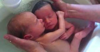 Hugging twin video goes viral