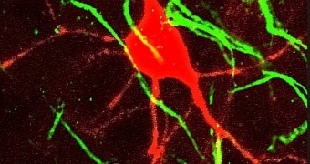 Researchers find brain cells that have an axon attached to one of their dendrites