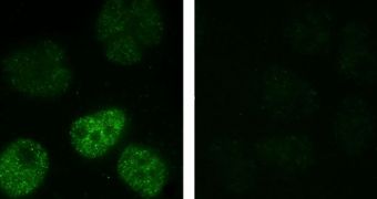 When human lung epithelial cells are exposed to equivalent doses of nano-sized (left) or micro-sized (right) metallic nickel particles, activated HIF-1 pathways (green) appear mostly with the nanoparticles