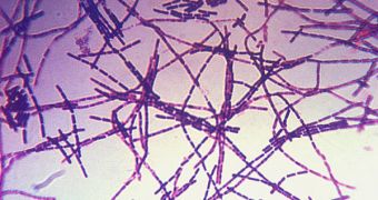 Anthrax spores, seen here through other viewing methods