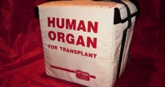 Organ donations have decreased over the past 5 years in the United States