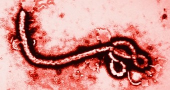 Nurse at Hospital in Dallas, Texas, Confirmed to Have Ebola