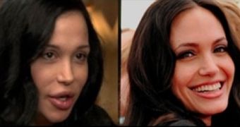 Nadya Suleman, Octo-Mom, has had surgery to look like Angelina Jolie, it has been said