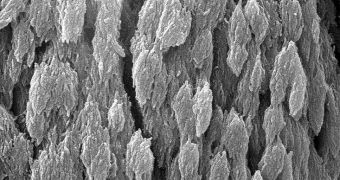 This SEM image shows the close-up structure of a bone