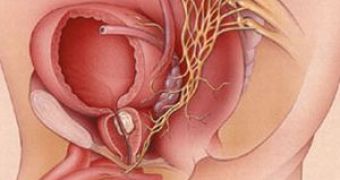 Omega - 3 Intake Slows Prostate Cancer