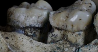 Our ancestors had bad teeth because they overused toothpicks, researchers say
