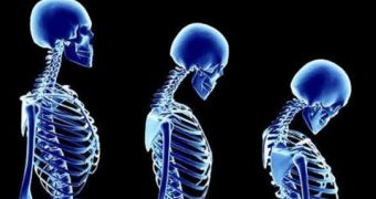 Fat affects the bone marrow, ups osteoporosis risk