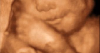 3-D ultrasound image of the fetus inside the womb