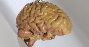 Mcor 3D printed brain
