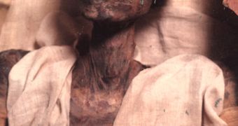 The mummy of Ramses II