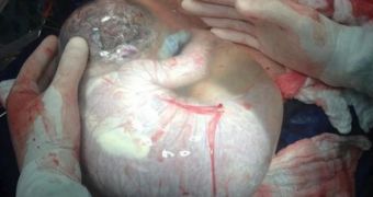 Picture shows newborn in its amniotic sac (click to see full image)